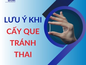 Lưu Ý Khi Cấy Que Tránh Thai: Những Điều Bạn Cần Biết