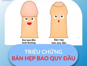 BÁN HẸP BAO QUY ĐẦU: TRIỆU CHỨNG, NGUYÊN NHÂN VÀ ĐIỀU TRỊ TẠI PHÒNG KHÁM ĐA KHOA CHỢ CẦU