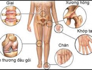 Tìm hiểu về bệnh xương khớp thường gặp